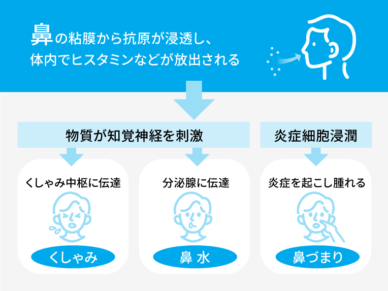 花粉が鼻の症状を引き起こすメカニズム